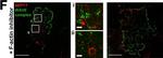 Rabbit IgG (H+L) Cross-Adsorbed Secondary Antibody in Immunocytochemistry (ICC/IF)