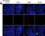 Human IgG (H+L) Cross-Adsorbed Secondary Antibody in Immunocytochemistry (ICC/IF)