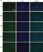 Mouse IgG1 Cross-Adsorbed Secondary Antibody in Immunocytochemistry (ICC/IF)