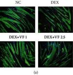 Mouse IgG1 Cross-Adsorbed Secondary Antibody in Immunohistochemistry (IHC)