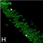 Mouse IgG (H+L) Highly Cross-Adsorbed Secondary Antibody in Immunocytochemistry (ICC/IF)