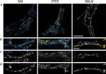 Mouse IgG (H+L) Highly Cross-Adsorbed Secondary Antibody in Immunocytochemistry (ICC/IF)