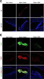 Mouse IgG (H+L) Highly Cross-Adsorbed Secondary Antibody in Immunohistochemistry (PFA fixed) (IHC (PFA))