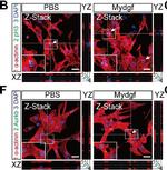 Mouse IgG (H+L) Highly Cross-Adsorbed Secondary Antibody in Immunohistochemistry (IHC)