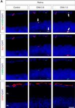 Rabbit IgG (H+L) Highly Cross-Adsorbed Secondary Antibody in Immunohistochemistry (PFA fixed) (IHC (PFA))