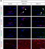 Rabbit IgG (H+L) Highly Cross-Adsorbed Secondary Antibody in Immunohistochemistry (PFA fixed) (IHC (PFA))