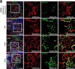 Rabbit IgG (H+L) Highly Cross-Adsorbed Secondary Antibody in Immunohistochemistry (IHC)