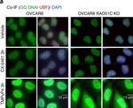 Mouse IgG (H+L) Highly Cross-Adsorbed Secondary Antibody in Immunocytochemistry (ICC/IF)