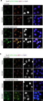 Mouse IgG (H+L) Highly Cross-Adsorbed Secondary Antibody in Immunocytochemistry (ICC/IF)