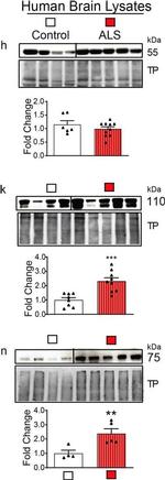 Mouse IgG (H+L) Cross-Adsorbed Secondary Antibody in Western Blot (WB)