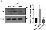 Rabbit IgG (H+L) Cross-Adsorbed Secondary Antibody in Western Blot (WB)