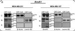 Rabbit IgG (H+L) Cross-Adsorbed Secondary Antibody in Western Blot (WB)