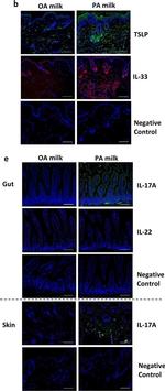 Rabbit IgG (H+L) Highly Cross-Adsorbed Secondary Antibody in Immunohistochemistry (IHC)