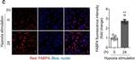 Rabbit IgG (H+L) Highly Cross-Adsorbed Secondary Antibody in Immunocytochemistry (ICC/IF)