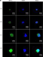 Rabbit IgG (H+L) Secondary Antibody in Immunocytochemistry (ICC/IF)