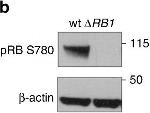 Rabbit IgG (H+L) Secondary Antibody in Western Blot (WB)