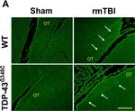 Rabbit IgG (H+L) Secondary Antibody in Immunohistochemistry (IHC)