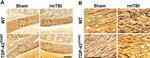 Rabbit IgG (H+L) Secondary Antibody in Immunohistochemistry (IHC)