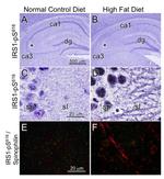 Phospho-IRS1 (Ser616) Antibody in Immunocytochemistry, Immunohistochemistry, Immunohistochemistry (Paraffin) (ICC/IF, IHC, IHC (P))