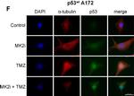 Rabbit IgG (H+L) Cross-Adsorbed Secondary Antibody in Immunocytochemistry (ICC/IF)