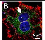 Rabbit IgG (H+L) Cross-Adsorbed Secondary Antibody in Immunocytochemistry (ICC/IF)