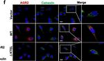 Rabbit IgG (H+L) Highly Cross-Adsorbed Secondary Antibody in Immunocytochemistry (ICC/IF)