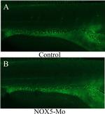 Mouse IgG (H+L) Cross-Adsorbed Secondary Antibody in Immunocytochemistry (ICC/IF)