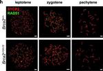 Rabbit IgG (H+L) Cross-Adsorbed Secondary Antibody in Immunocytochemistry (ICC/IF)