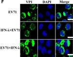 Rabbit IgG (H+L) Cross-Adsorbed Secondary Antibody in Immunocytochemistry (ICC/IF)