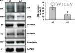 alpha Catenin Antibody in Western Blot (WB)