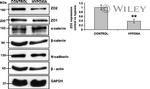 alpha Catenin Antibody in Western Blot (WB)