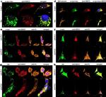 Mouse IgG (H+L) Cross-Adsorbed Secondary Antibody in Immunocytochemistry (ICC/IF)