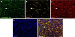 Mouse IgG (H+L) Cross-Adsorbed Secondary Antibody in Immunohistochemistry (Paraffin) (IHC (P))