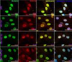 Mouse IgG (H+L) Cross-Adsorbed Secondary Antibody in Immunocytochemistry (ICC/IF)