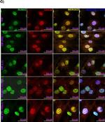 Mouse IgG (H+L) Cross-Adsorbed Secondary Antibody in Immunocytochemistry (ICC/IF)