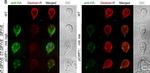 Rat IgG (H+L) Cross-Adsorbed Secondary Antibody in Immunocytochemistry (ICC/IF)