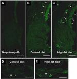 Rat IgG (H+L) Cross-Adsorbed Secondary Antibody in Immunohistochemistry (Frozen) (IHC (F))