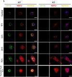 Rabbit IgG (H+L) Highly Cross-Adsorbed Secondary Antibody in Immunocytochemistry (ICC/IF)