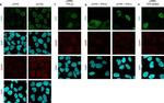 Rabbit IgG (H+L) Highly Cross-Adsorbed Secondary Antibody in Immunocytochemistry (ICC/IF)