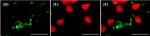 Rabbit IgG (H+L) Highly Cross-Adsorbed Secondary Antibody in Immunocytochemistry (ICC/IF)