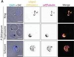 Mouse IgG (H+L) Highly Cross-Adsorbed Secondary Antibody in Immunocytochemistry (ICC/IF)