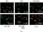 Rabbit IgG (H+L) Cross-Adsorbed Secondary Antibody in Immunocytochemistry (ICC/IF)