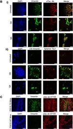 Rabbit IgG (H+L) Cross-Adsorbed Secondary Antibody in Immunocytochemistry (ICC/IF)