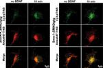 Mouse IgG (H+L) Highly Cross-Adsorbed Secondary Antibody in Immunocytochemistry (ICC/IF)