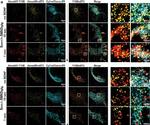 Rabbit IgG (H+L) Cross-Adsorbed Secondary Antibody in Immunocytochemistry (ICC/IF)