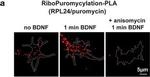 Rabbit IgG (H+L) Cross-Adsorbed Secondary Antibody in Immunocytochemistry (ICC/IF)