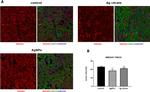 Mouse IgG1 Cross-Adsorbed Secondary Antibody in Immunohistochemistry (IHC)