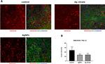 Mouse IgG1 Cross-Adsorbed Secondary Antibody in Immunohistochemistry (IHC)