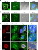 Rabbit IgG (H+L) Cross-Adsorbed Secondary Antibody in Immunocytochemistry (ICC/IF)