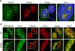 Rabbit IgG (H+L) Highly Cross-Adsorbed Secondary Antibody in Immunocytochemistry (ICC/IF)